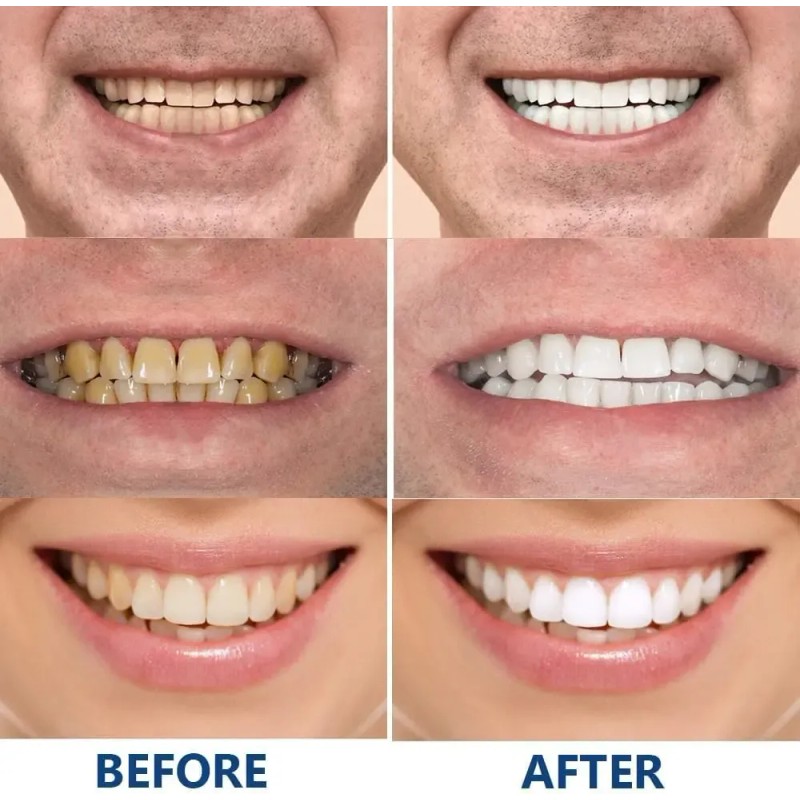 . Pasta De Dientes Geelike Nano Hydroxyapatite .