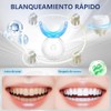 Kit Blanqueamiento Dental Cluye Bolígrafos Blanqueadores Luz Led Tabla Colores