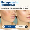 Exderm White Crema Despigmentante Intensiva De Noche 30 Ml Tipo