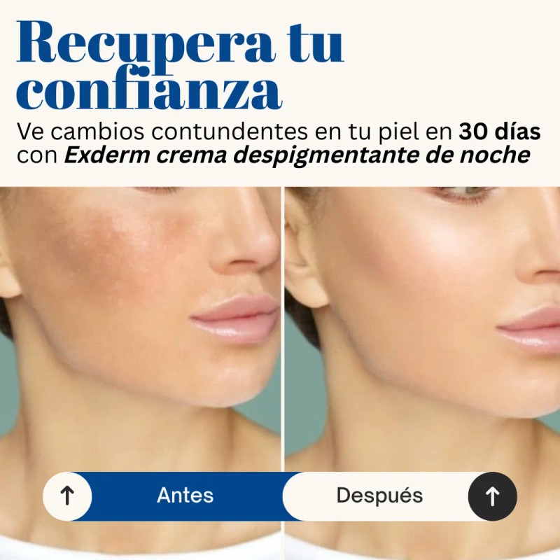Exderm White Crema Despigmentante Intensiva De Noche 30 Ml Tipo