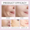 Parches Liftantes Faciales 40pzs | Reafirman, Definen V