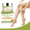 Crema Varices Mejor Apariencia De Tus Piernas Alivia Dolor