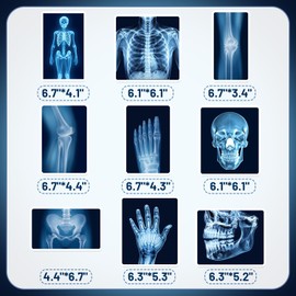 9Pcs Radiology X Ray Honeycomb Centerpieces Radiology Party Favors Birthday Party Decorations X Ray Centerpieces Decorations Supplies for Radiology Xray Doctor Medical Theme Party Baby Shower Supplies