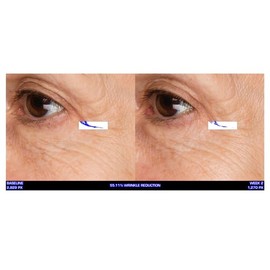 Serious Skincare Ultra-Mare Pure Marine Infusion Revitalizing Eye Cream - Marine Peptides & Minerals - Skin Renewing Concentrated Formula - 0.5 oz (1pack)