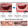 【🔥Special Offer】Activated carbon toothpaste 100g for removing tartar, removing yellow