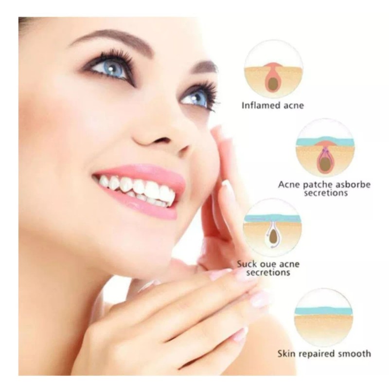 Universo en Linea 120 Parches Acné Espinillas Facial Absorbente Invisibles