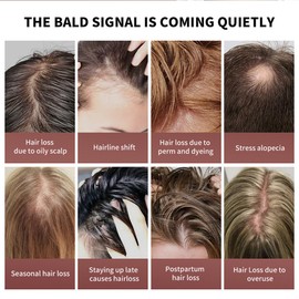 Batana Öl für Haar Wachstum und Reparatur, Raw Batana Öl für Haar Gesundheit Wachstum, Unverarbeitetes Öl Verhindert Haarausfall und Erhöht die Haardichte Bei Männern und Frauen