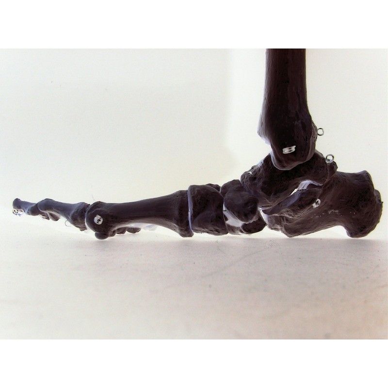 Orthopädische Weichpolstereinlage bei Hallux valgus stützt bei Knick- Senk- Spreizfüßen