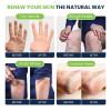 Foot Cure Crema Eliminación Talón Agrietado Picazón Y Tiña