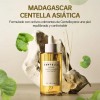 Skin1004 Ampolla Centella Asiática Madagascar Calmante 100ml