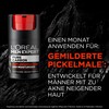 L'Oréal Men Expert Anti-Pimple Moisturiser, Effectively Fights Pimples, Pure Carbon,