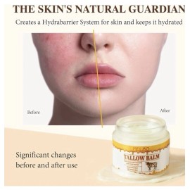 Melao Beef Tallow & Honey Balm for Face & Skin, 100% Grass-Fed Beef Tallow Moisturizer