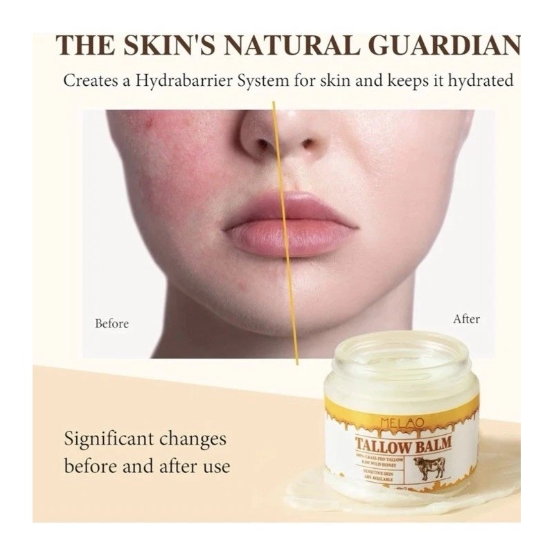 Melao Beef Tallow & Honey Balm for Face & Skin,