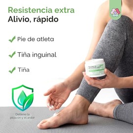 Roycederm Tratamiento de Tiña Versicolor, Tratamiento de Pie de Atleta, Tratamiento de Tiña para Humanos, para Tiña Versicolor y Pedis, Crema Antifúng