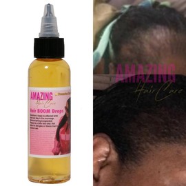 7 Day Fast Hair Boom Drops Hair Growth Oil Ginger Growth Hair Treatment Anti Hair Loss Men Women Scalp Treatment Serum Products Beauty Product