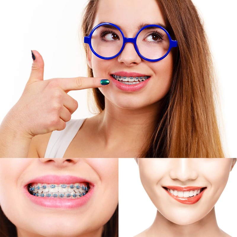 Rubber Bands for Braces, 1040 Pcs Color Orthodontic Ligature Ties