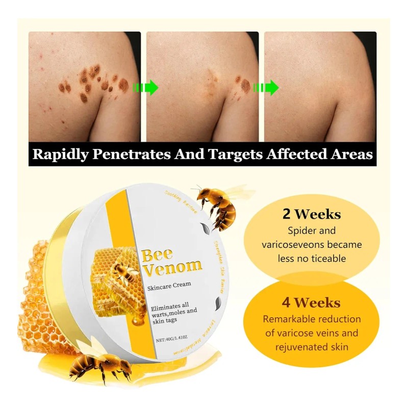 Crema De Tratamiento Para La Piel Que Reduce Las Imperfeccio