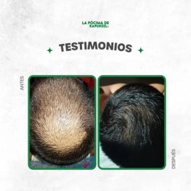 Kit Shampoo Fortificante Anticaída +acondicionador De Regalo