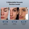 ViQure Professional Blackhead Remover Pore Vacuum with Hot & Cold