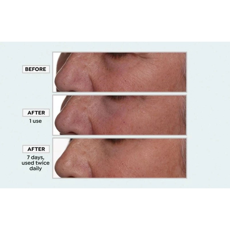 Nakery Beauty Lift-TOX 360 Firming Eye Lift Treatment Cream 1.01