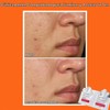 Dr. Dennis Gross Skincare Alpha Beta Peel, Extra Strength, 60