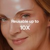Facelift Par