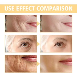 Eliminador de arrugas instantáneo, crema reafirmante, suero facial antiedad instantáneo, reafirma y reafirma la piel, nutre y repara profundamente, suaviza las líneas de expresión (1)
