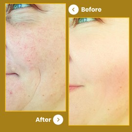 Healthy Care Sheep Placenta Capsules - Premium Dietary Supplement for Vitality & Overall Health - Sugar-Free - 100 Capsules