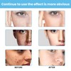 Crema para Manchas Oscuras en La Cara, Cremas para Quitar