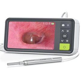 AnyScope 1080P Digital Otoscope with Gyroscope, 3.9mm Ear Scope Camera with 6 Lights, 4.5 Inches Screen, Ear Wax Removal Tool, 32GB Card, Supports Photo Snap and Video Recording