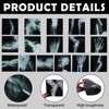 16Pcs Realistic Broken Bones X-Ray (9.8"x9.8") Skeleton X-Rays Human Skeleton