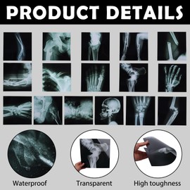 16Pcs Realistic Broken Bones X-Ray (9.8"x9.8") Skeleton X-Rays Human Skeleton Broken Bones PVC Plastic X-Ray Pretend Play Doctor Kit Learning Toy for Role-Playing Homeschooling School Supplies