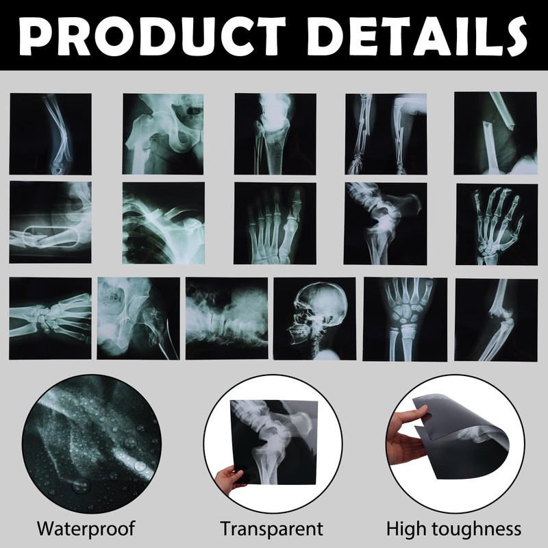 16Pcs Realistic Broken Bones X-Ray (9.8"x9.8") Skeleton X-Rays Human Skeleton
