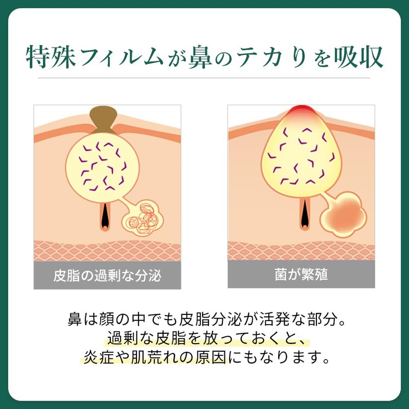 武内製薬 THE スポットエイド 鼻用