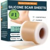 Parches Silicona Cicatrices Rollo Reutilizable Recortable Flexible Cómodo Grado Médico