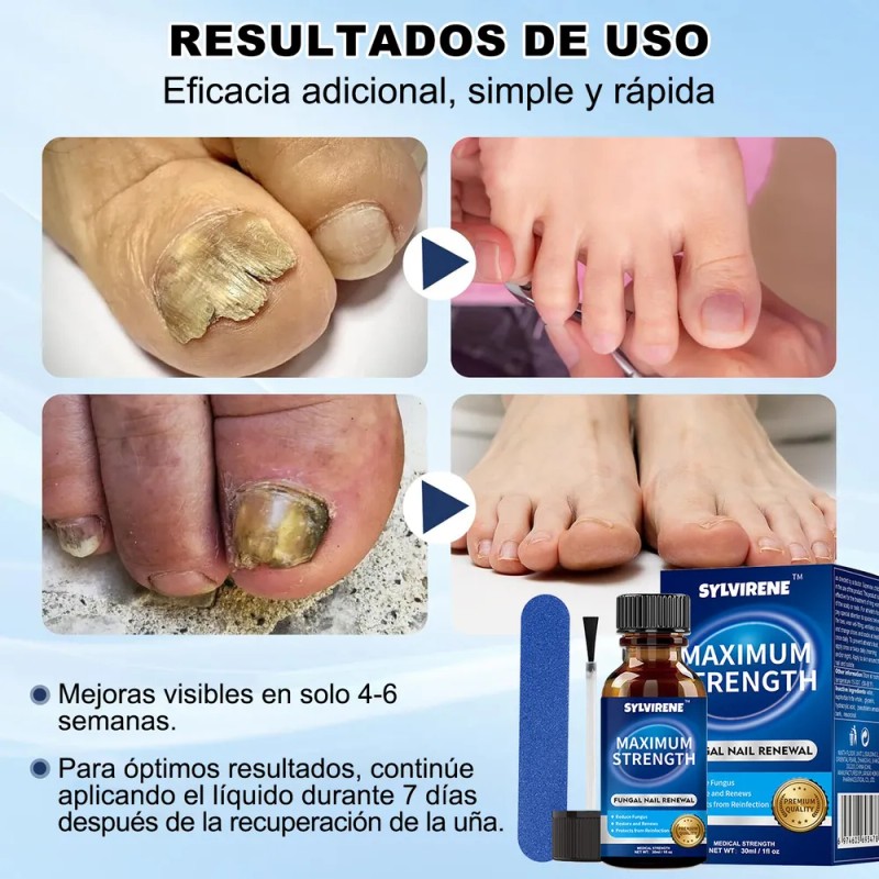 Líquido Para Hongos En Uñas - Cur-a Hongos Y Onicomicosis