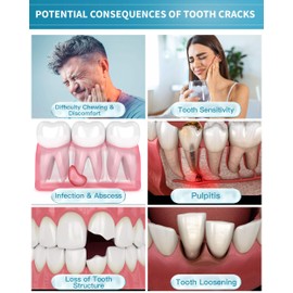 CAREDO Healing Teeth Crack Toothpaste, The ONLY Toothpaste Repairing Cracked Teeth Enamel Cracks, Cure Tooth Sensitivity, Remove Pigment in Crack 100g 2 Counts As Mother's Day Gift