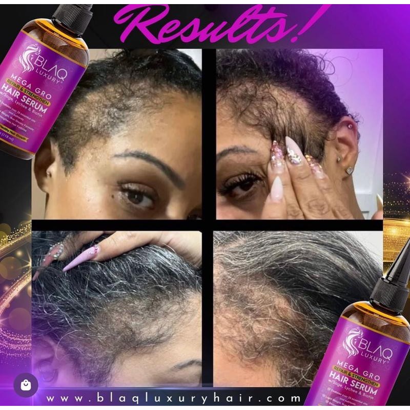 BLAQ LUXURY Mega Gro Repair and Strengthen Hair Serum