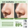2pcs Mascarilla En Barra De Arcilla Puntos Negros Exfoliante