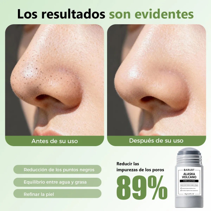 2pcs Mascarilla En Barra De Arcilla Puntos Negros Exfoliante