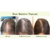 Best Acondicionador de Pérdida de Cabello Terapia de Crecimiento Rápido