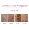 Hidratante Cuidado Facial Limpiador, Sakura Facial Wash 1pcs