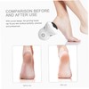 Ipetboom 10pcs Electric Foot Replacement Heads for Pedicure Suitable for