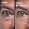 Dr.Brandt Gel desinflamante de ojos, 15 g