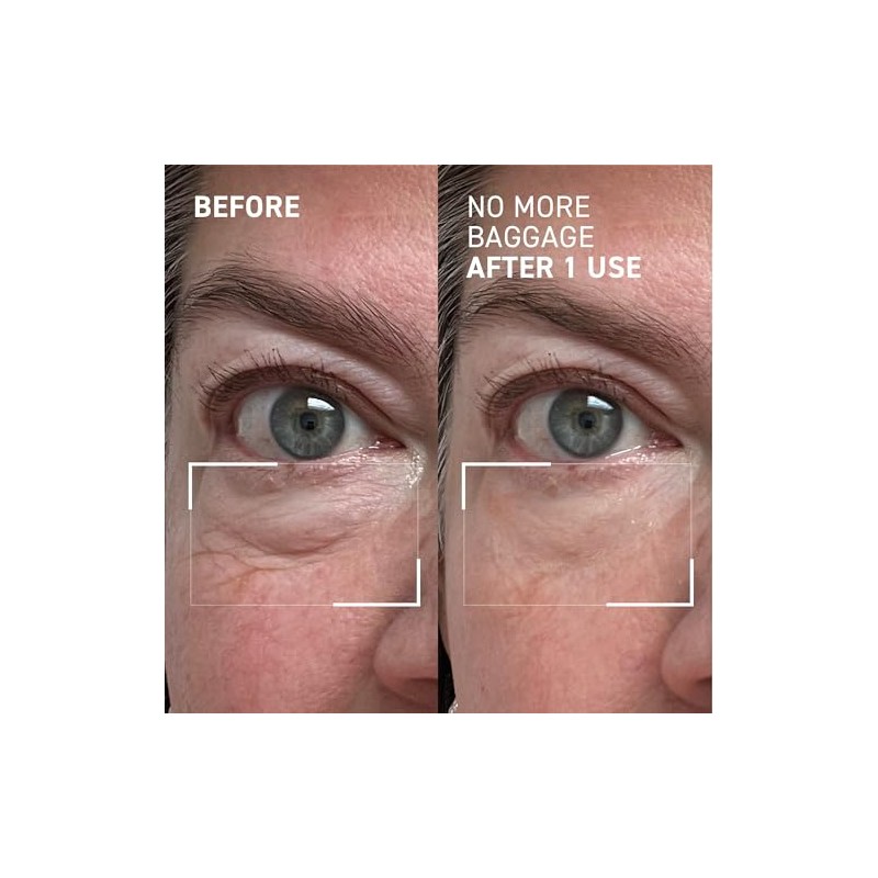 Dr.Brandt Gel desinflamante de ojos, 15 g