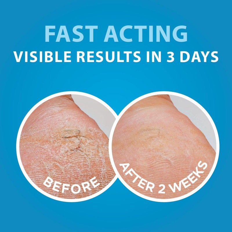 Dermal Therapy Heel Magic | Easy to Use Stick Applicator