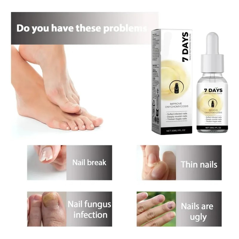 I Nail Repair Essence Repara La - Tt I