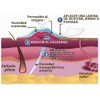 Scar Aid, tira de silicón grado médico, reduce cicatrices por