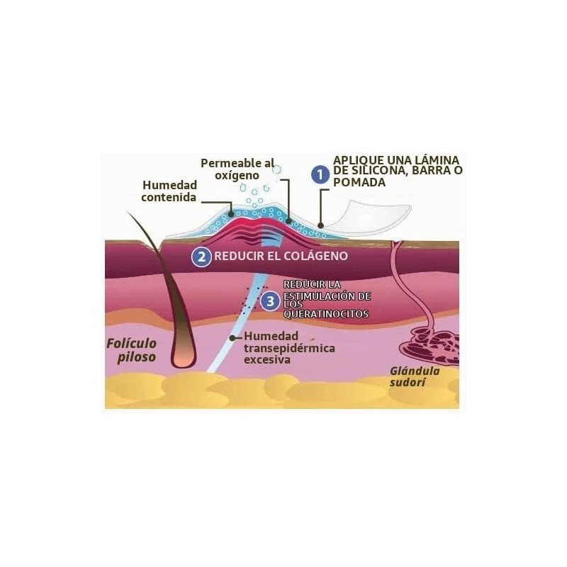 Scar Aid, tira de silicón grado médico, reduce cicatrices por