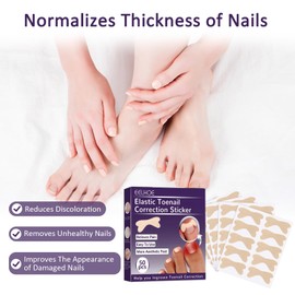 100 Stück Nagelpflaster Nagel Reparatur Pflaster Nail Repair Patches Pflaster Zehennagel Bequem und Atmungsaktiv, Unisex. Geeignet für Die Reparatur Von Verletzungen (10.6 * 11.2 * 1cm)